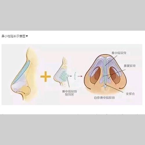 下载 (2).jpg