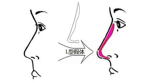 u=1696817786,2025094623&fm=26&gp=0.jpg
