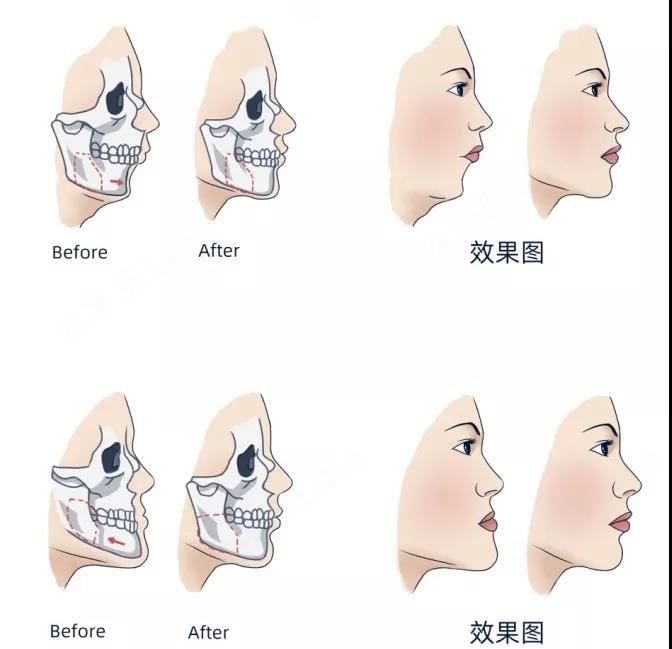src=http___cdn035.yun-img.com_static_upload_ruigeng_news_20190911110233_63231.jpg&refer=http___cdn035.yun-img.jpg
