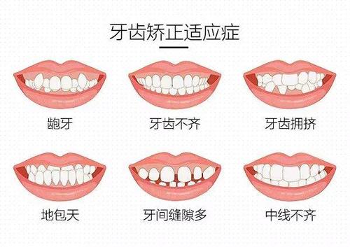 下载.jpg