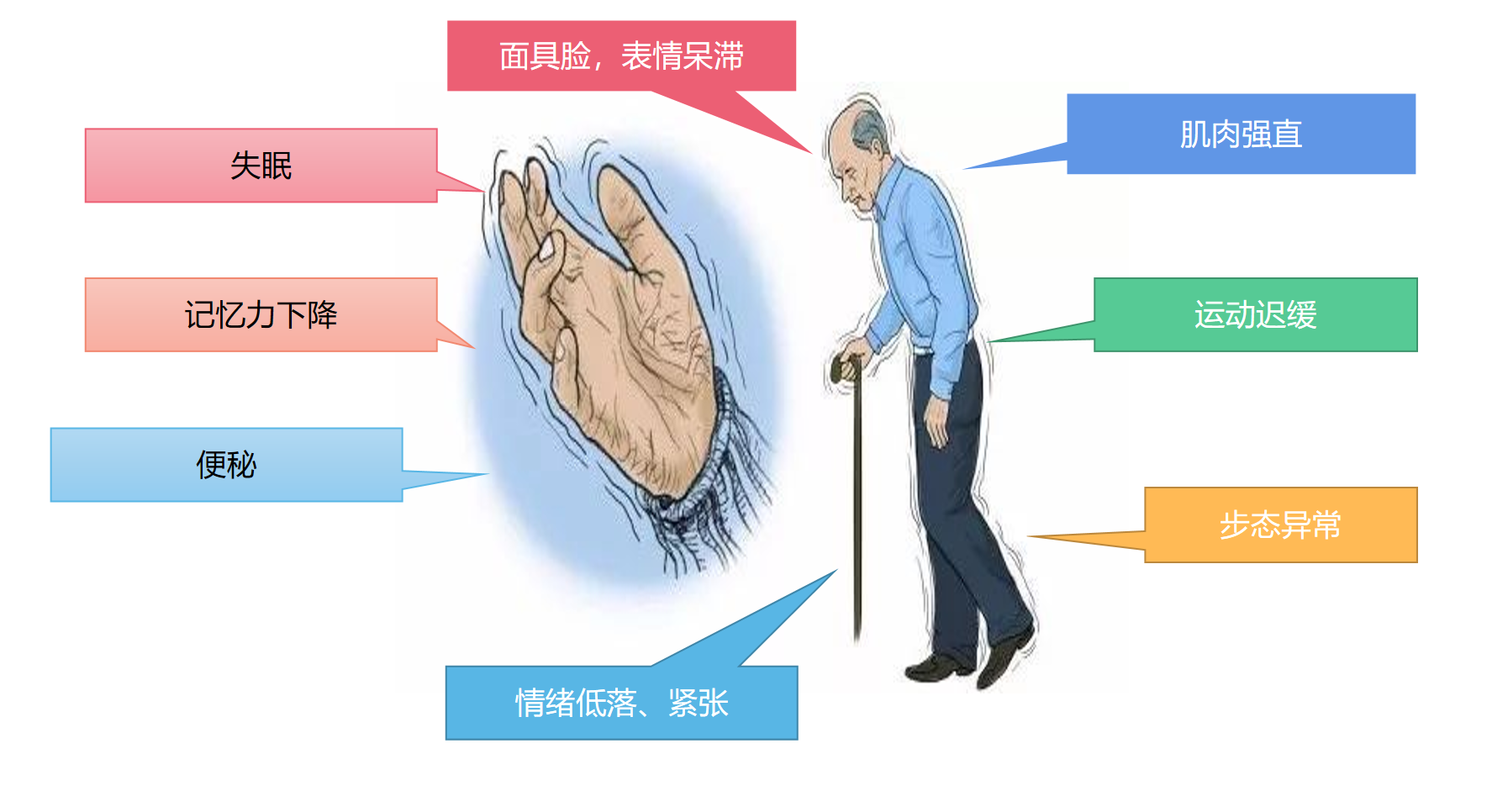 帕金森8.png