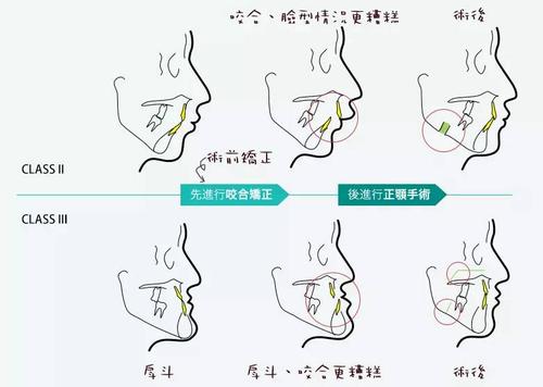 u=2577974674,3580824179&fm=26&gp=0.jpg