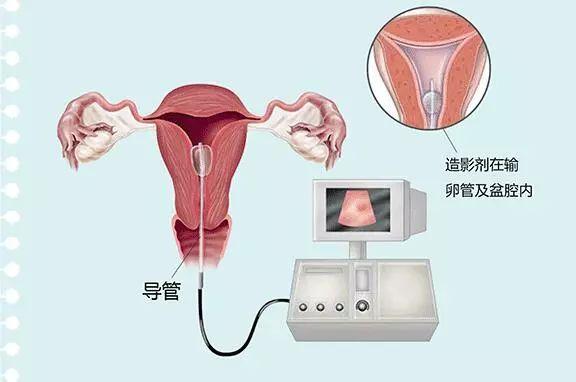src=http___inews.gtimg.com_newsapp_match_0_4615217580_0.jpg&refer=http___inews.gtimg.jpg