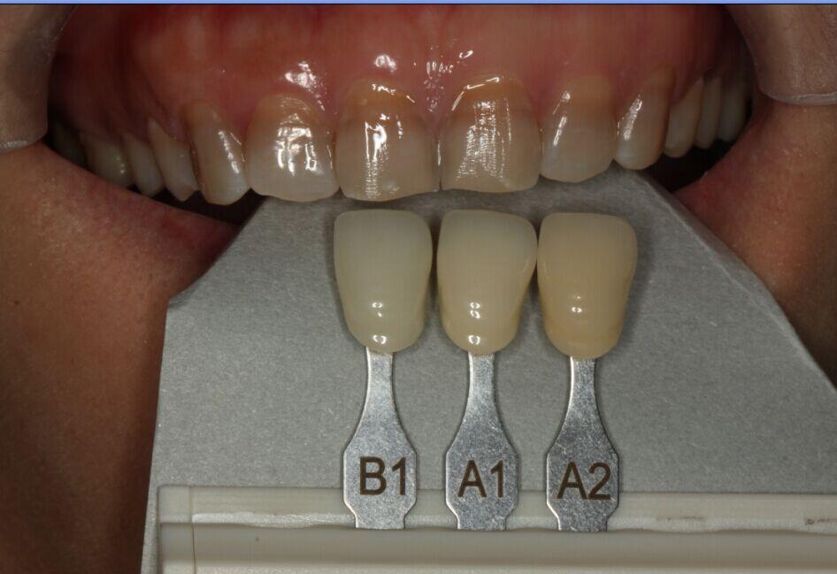 1618839393712553.jpg 17.jpg