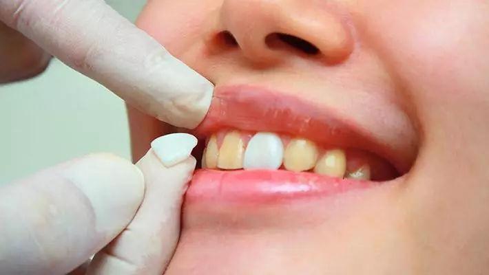 1618839630797598.jpg 19.jpg