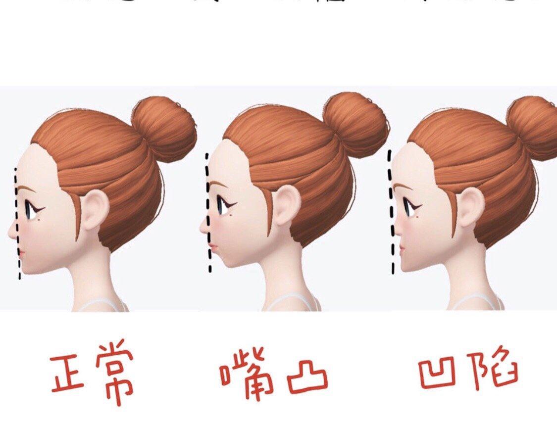 src=http___img2.soyoung.com_tieba_ios_post_20190918_0_48c9dad8c580986dcdaed54c169e8f4a.jpg&refer=http___img2.soyoung.jpg
