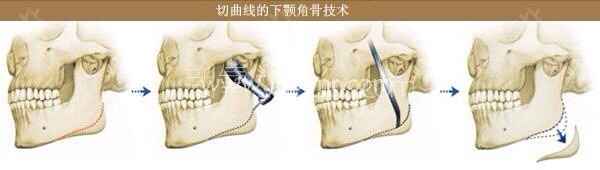 u=2926526914,925044657&fm=26&gp=0.jpg