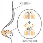u=3423841867,1267807489&fm=26&gp=0.jpg