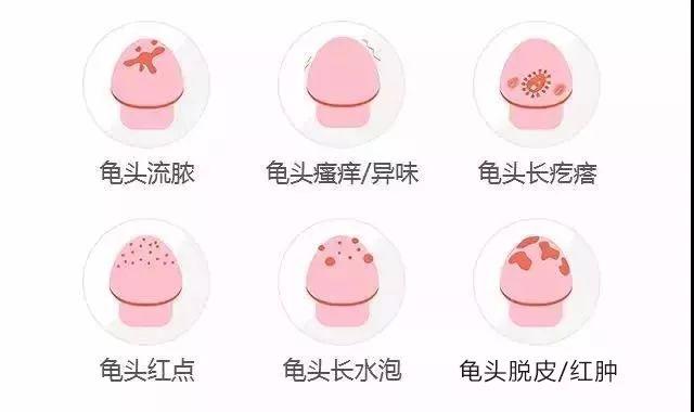 龟头炎.jpg