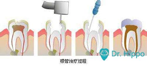 u=3740306233,3106398763&fm=26&gp=0.jpg