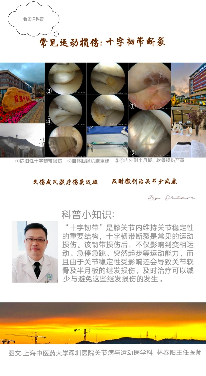 ACL断裂.jpg