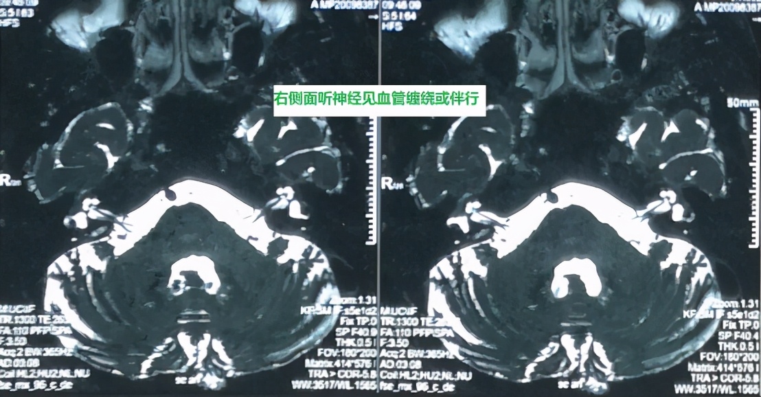 六旬女子忍受疼痛5年！就因为这一句话，多年的疼痛终于消失了