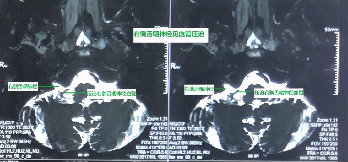 六旬女子忍受疼痛5年！就因为这一句话，多年的疼痛终于消失了