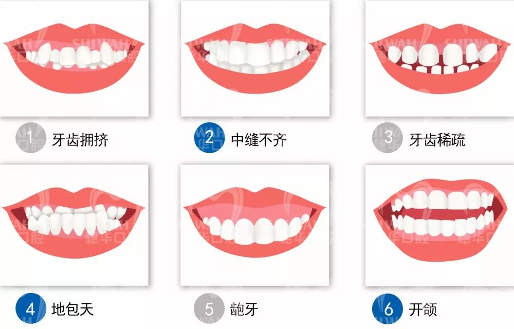 1621305209555894.jpg 畸形症状.jpg