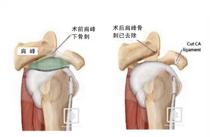 术前术后.jpg
