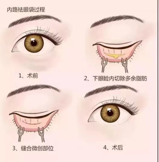 47db5b2f23a427e346c90d7fe452032.jpg