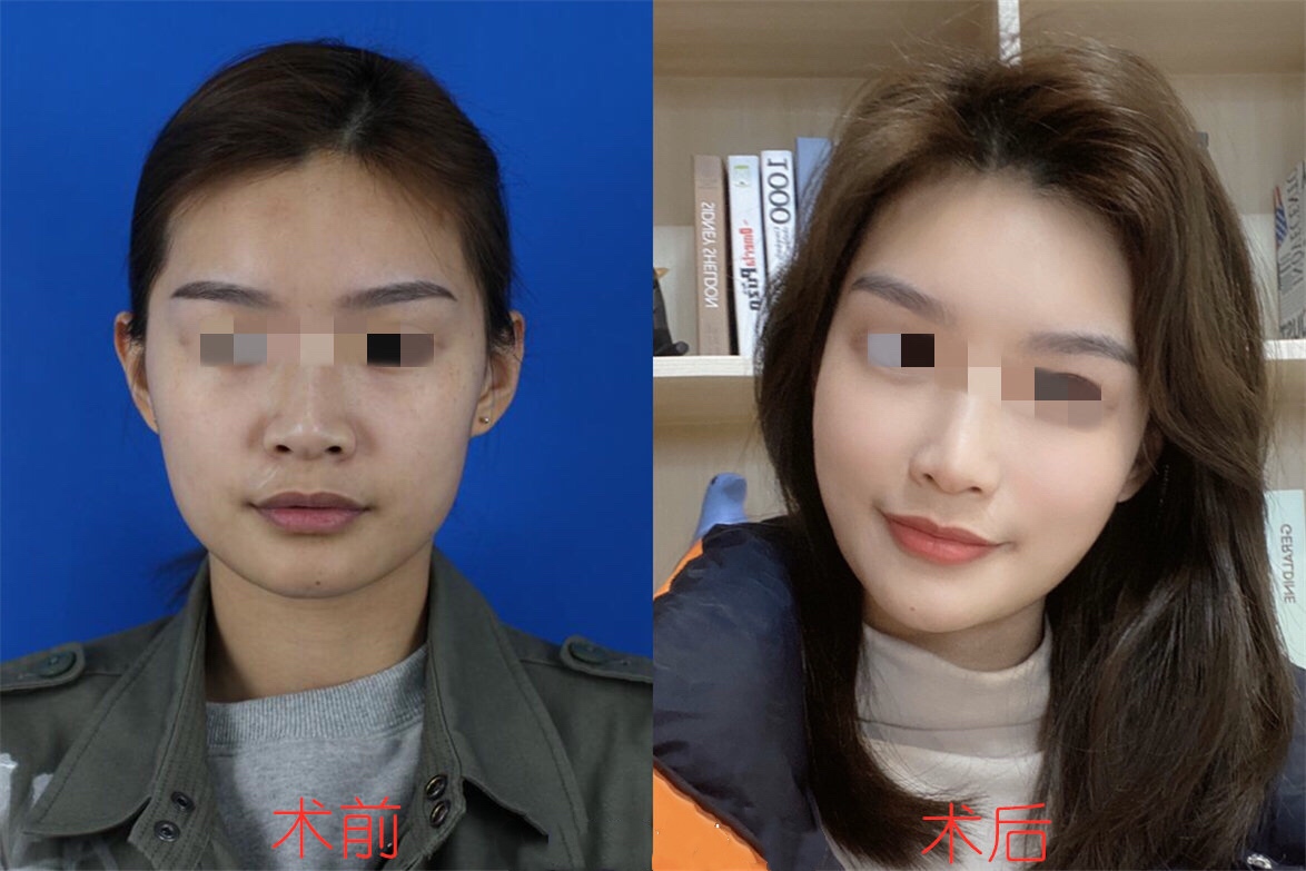 案例图.jpg