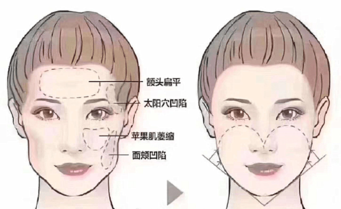图1.png