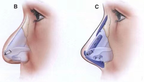 1623318543497527.jpg 图1.jpg