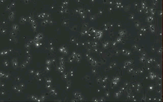 镜下精子图.gif