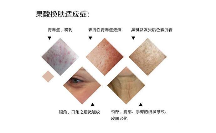 src=http___www.3ua.cn_uploads_allimg_200720_1950-200H0192430P3.png&refer=http___www.3ua.jpg