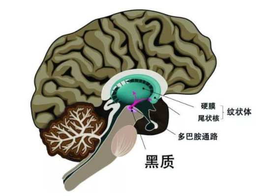 什么样的人群更容易得帕金森病？