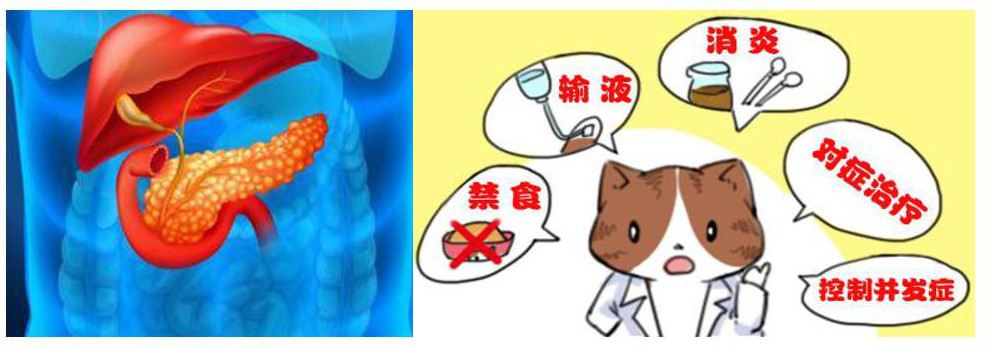 急性胰腺炎-治疗.jpg