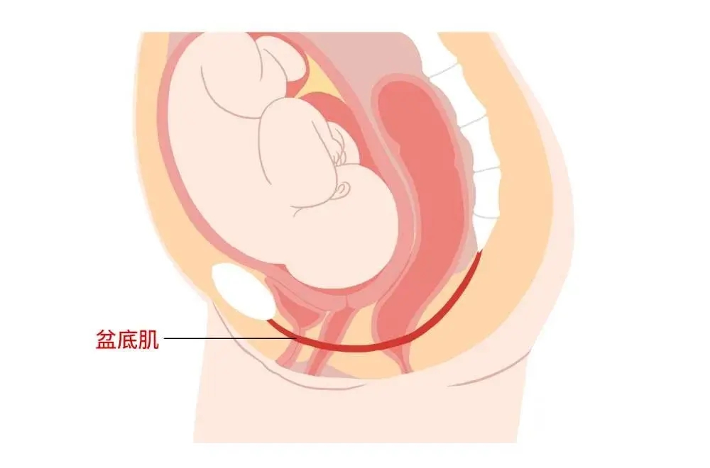 产后压力性尿失禁在所难免,因为盆底肌是指封闭骨盆底的肌肉群,这一