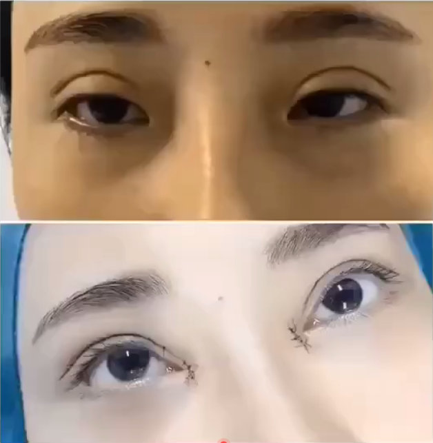 471a43e2gy1gpuw0zh2yoj20hg0hvgxc.jpg