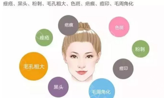 src=http___img2.soyoung.com_tieba_web_20190712_5_88d6cca3df7920947820ea04bf2cc3fb_570.png&refer=http___img2.soyoung.jpg