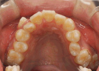 2.gif
