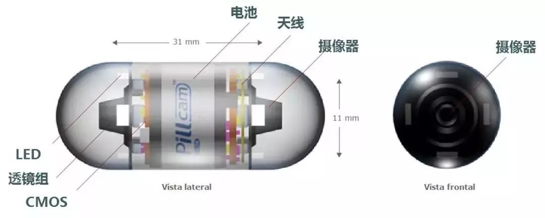 胶囊内镜.jpg