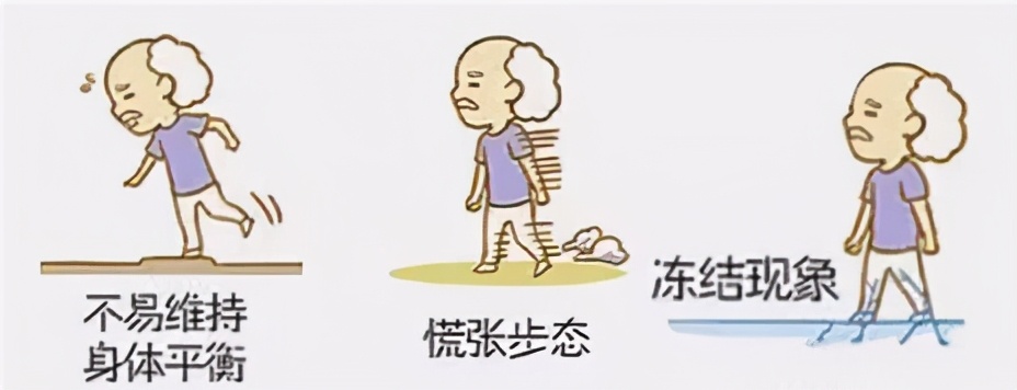 四个康复运动小技巧，让帕友们第一时间避免跌倒