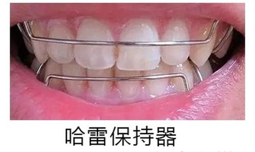 透明保持器和普通保持器的区别 