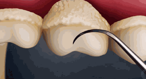 软垢.gif