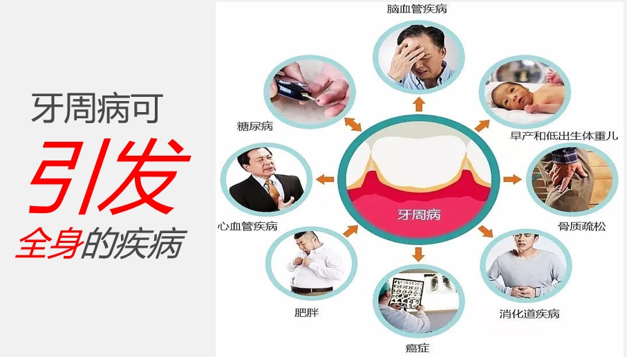 牙周炎与全身疾病.jpg