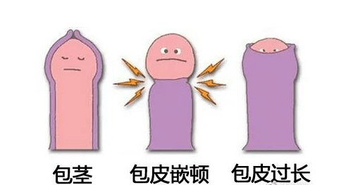 9bd5f11f424d4d20bed728aa5bcff19d.png