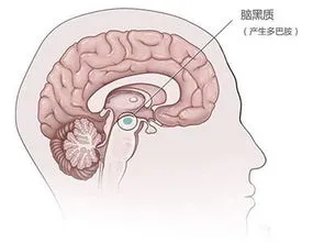 一场DBS手术终于让她重新站了起来
