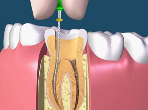 1-1P11015091O92[0].jpg