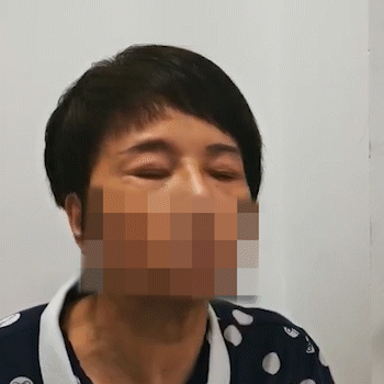 一场DBS手术，终于让我重新拥有正常生活