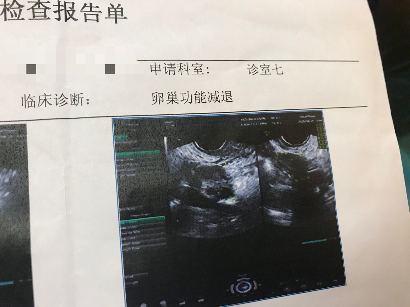 卵巢早衰逐步年轻化，山东医生带你了解10大元凶，外加注意事项
