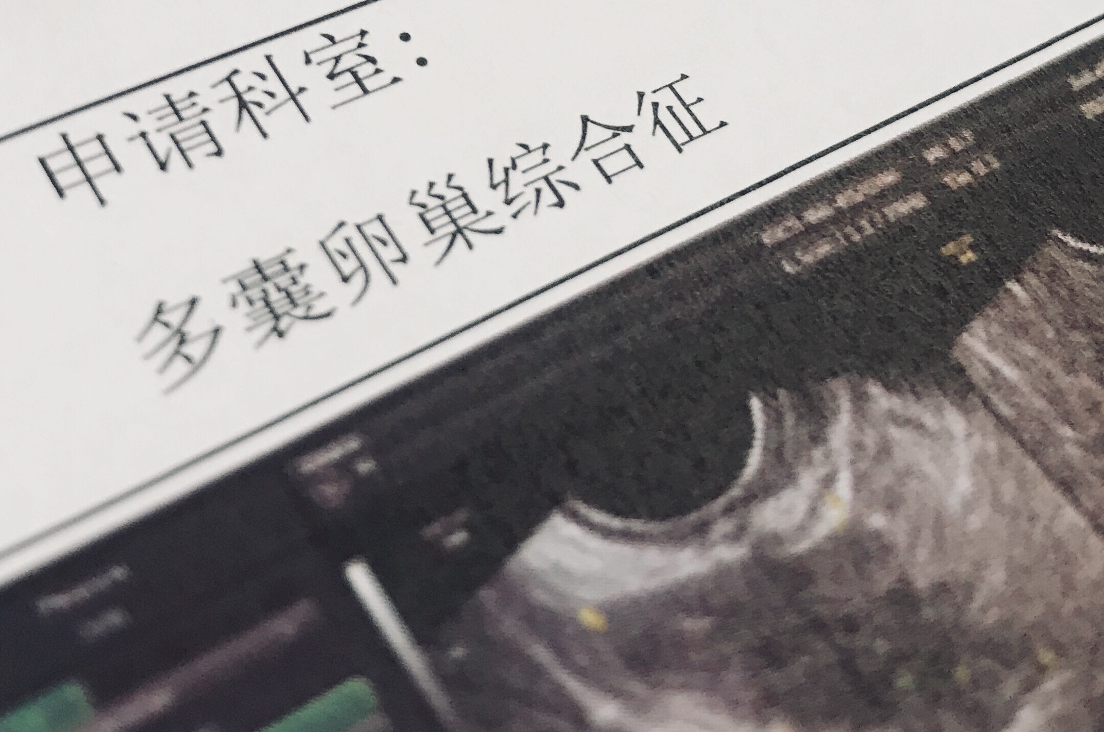 大姨妈推迟就只是怀孕？你还需警惕这4种情况