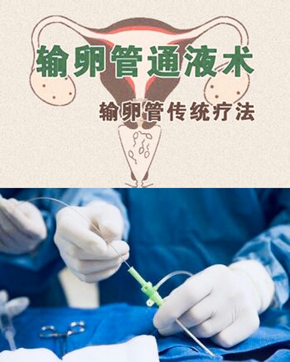 生殖科医生临床整理，关于不孕不育的14大误区，每1条都是关键点