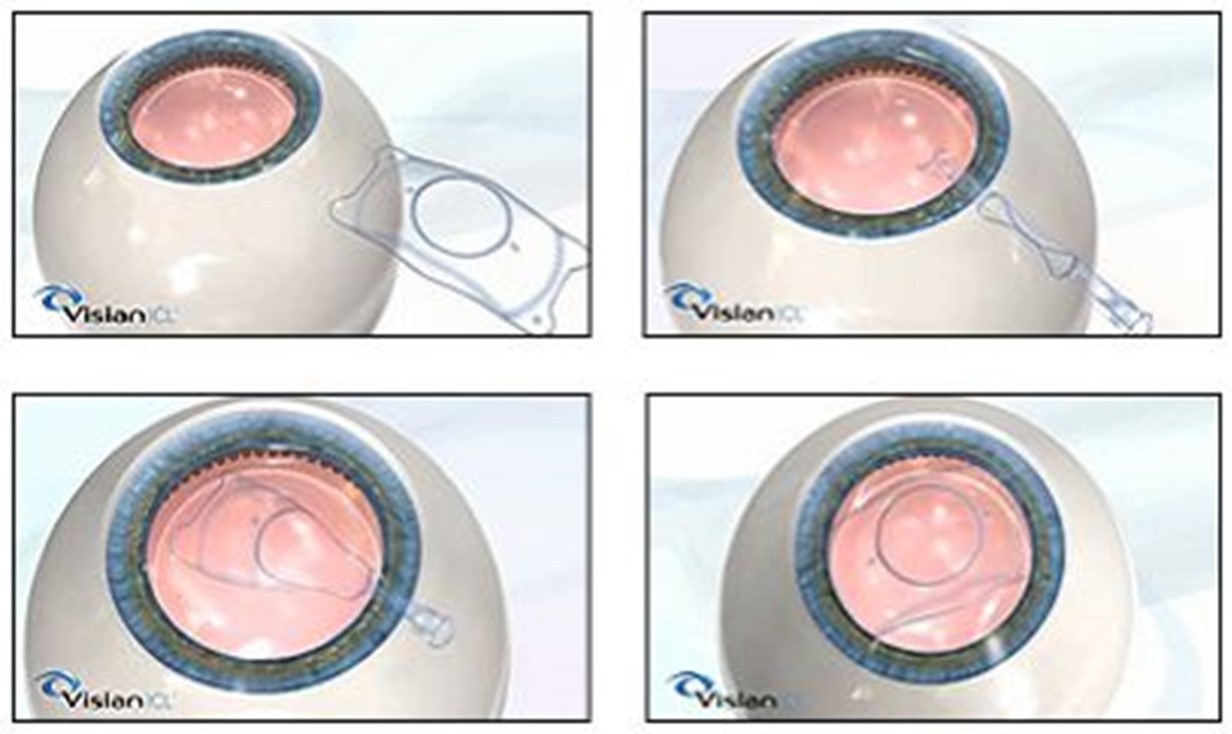 icl6.jpg
