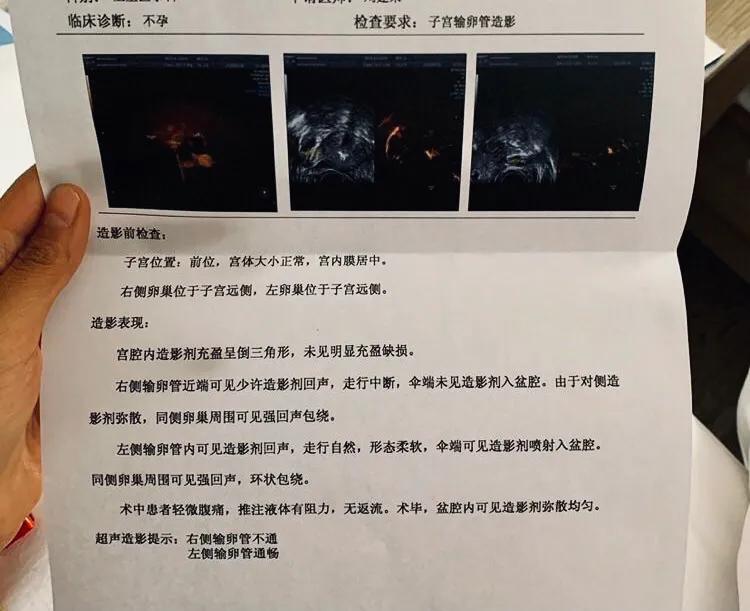 不孕症为何要查输卵管？生殖科医生带你全方位了解