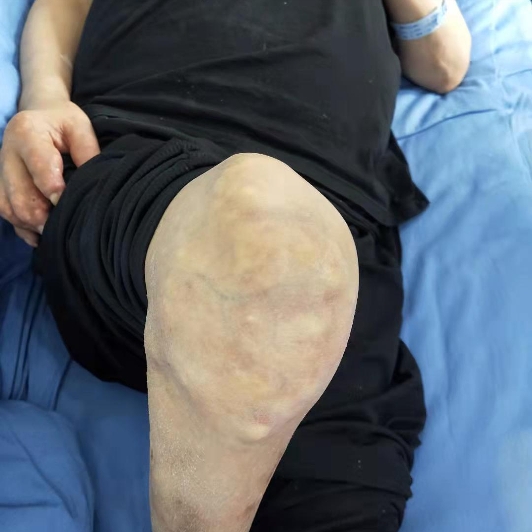 老年人膝盖痛有哪些原因？医生盘点6种疾病可能，个个危害都很大