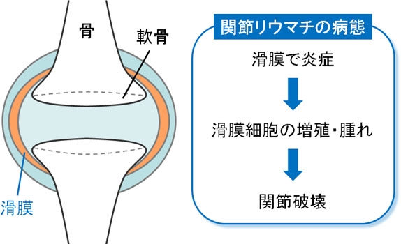 老年人膝盖痛有哪些原因？医生盘点6种疾病可能，个个危害都很大