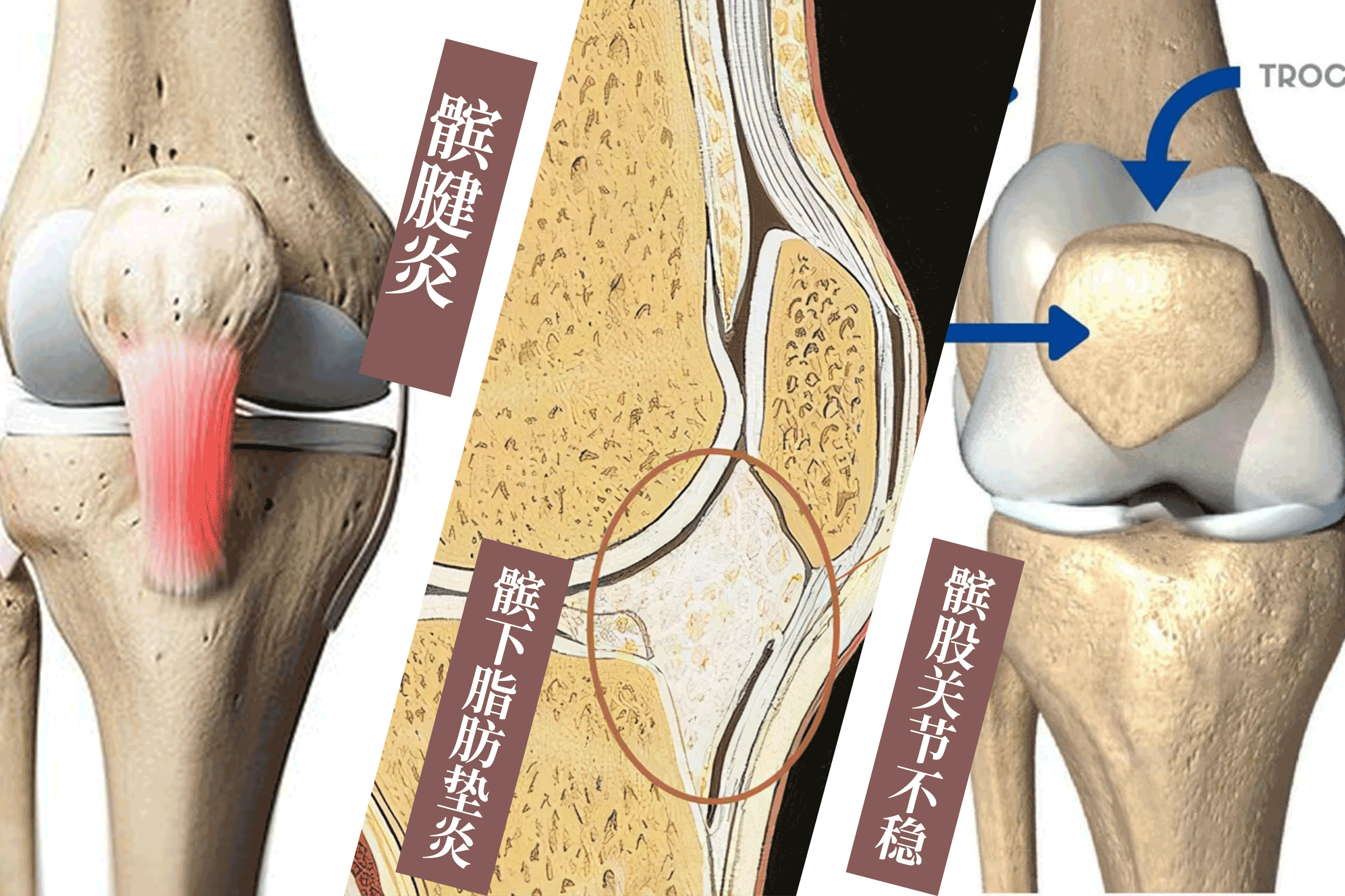 老年人膝盖痛有哪些原因 医生盘点6种疾病可能 健康160