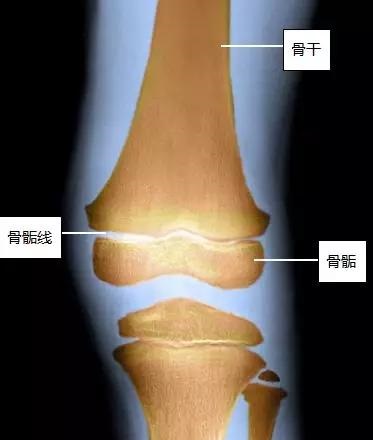 骨骺1.jpg