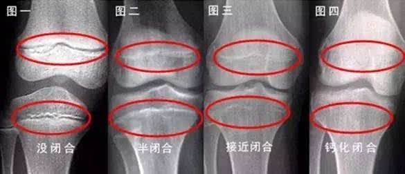 src=http___pic2.zhimg.com_50_v2-91330b8a45f7fa153c4ab52b53979d06_hd.jpg&refer=http___pic2.zhimg.jpg